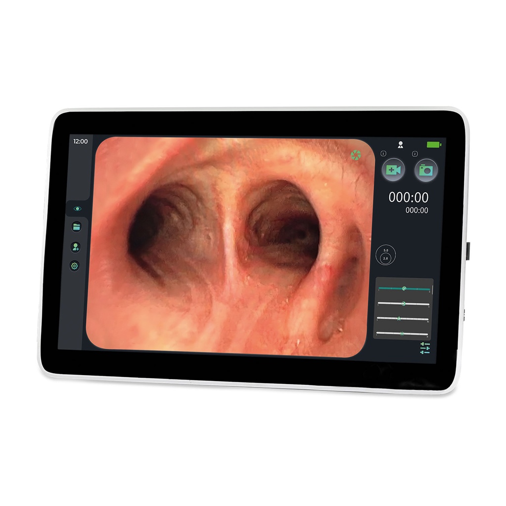 EickView SD Endoskopiemonitor, 15.6" Touchscreen